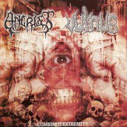 Vulnus : Combined Extremity